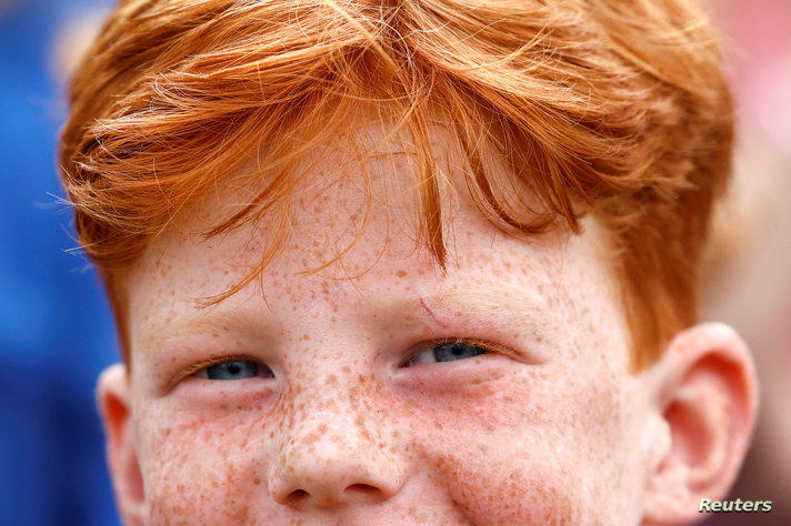 Hundreds of redheads from around the world take part in annual festival in Netherlands