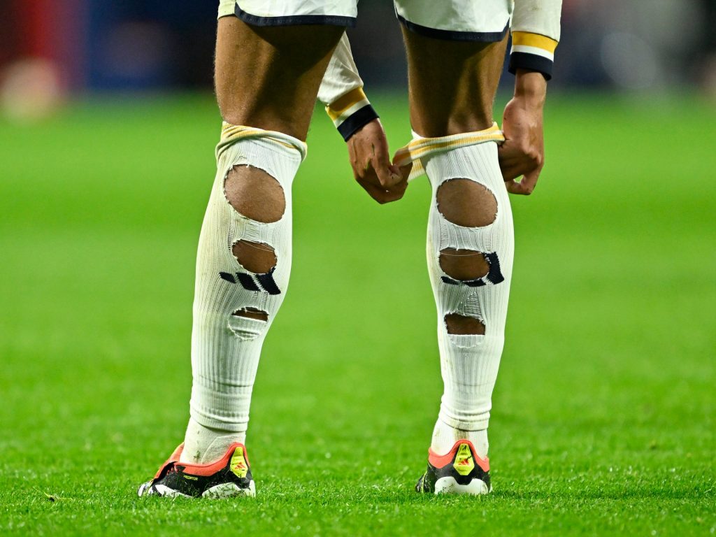 لماذا يمزق اللاعبون جواربهم وما رأي قانون كرة القدم؟