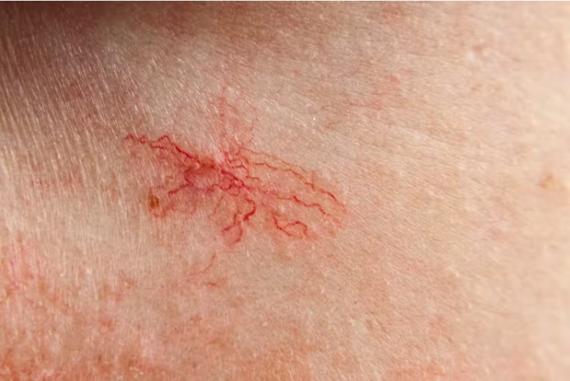 علامات على البشرة تؤشر لأمراض خفية.. كيف تعرفها؟