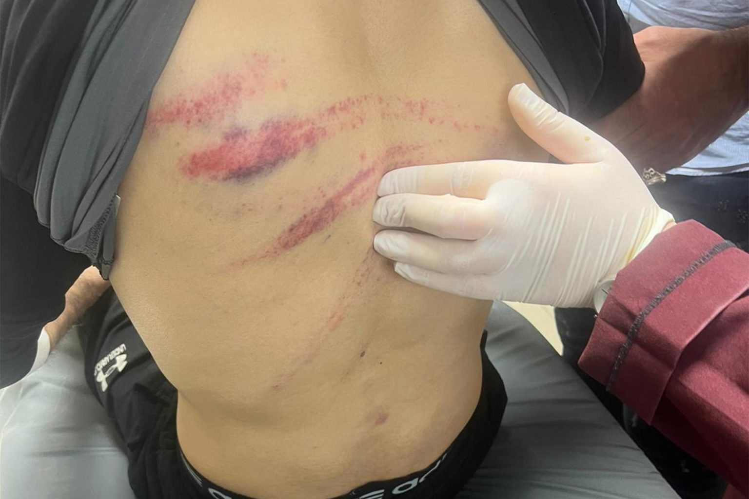 “إبراهيم حامد في خطر”.. فلسطيني يروي بجروحه قصص تعذيب الأسرى