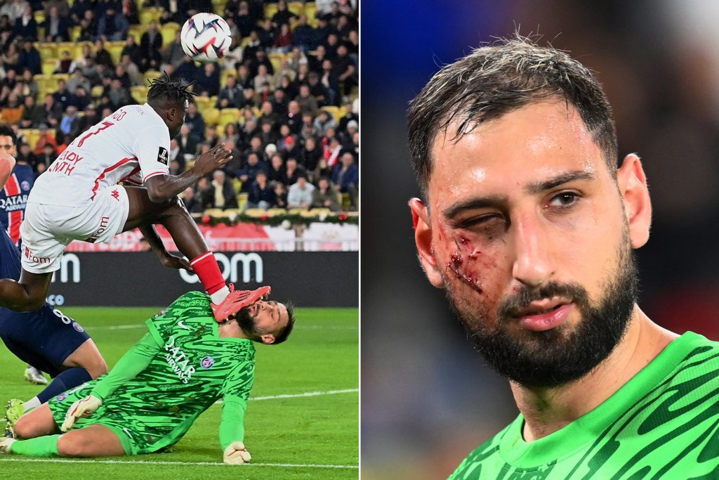 سينغو يعتذر بعد أن مزق وجه دوناروما