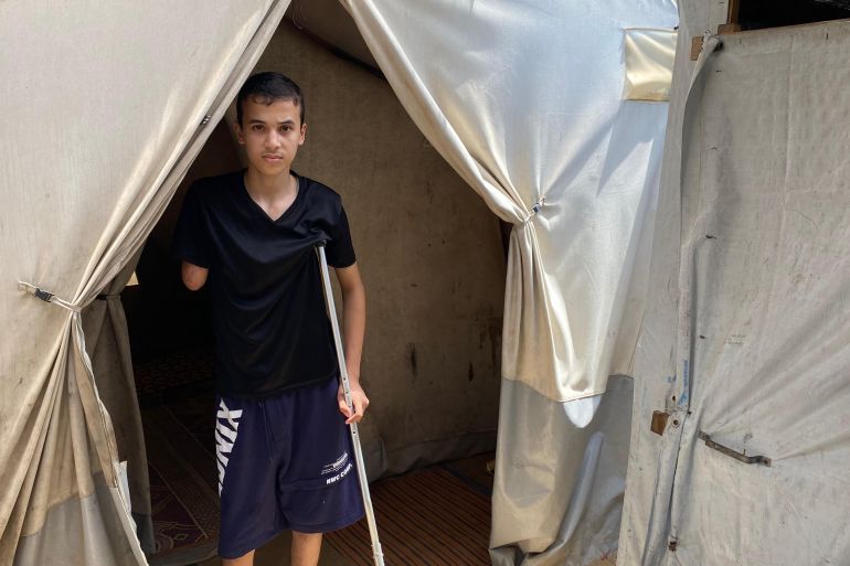 اجتمعت على عبيدة آلام الإصابة والجوع حيث يمنع الاحتلال الغذاء والدواء عن سكان قطاع غزة للشهر الخامس على التوالي-رائد موسى-دير البلح-الجزيرة نت