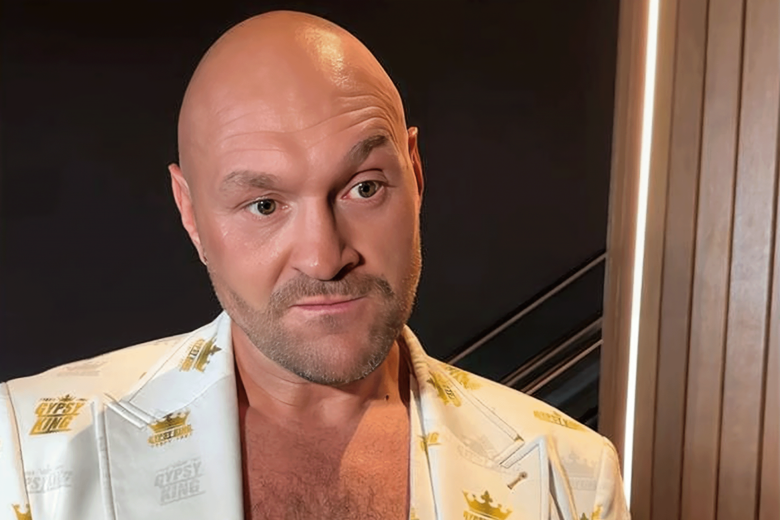 تايسون فيوري من إسطنبول: سأعود للثأر من أوسيك وأروني المال لأواجه جوشوا