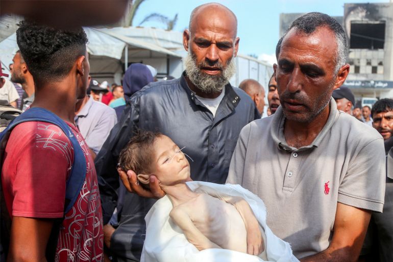 EDITORS NOTE: Graphic content / TOPSHOT - The father of Yahya Fadi al-Najjar, an infant who died due to malnourishment, holds his body during the funeral at Nasser Medical Complex in Khan Yunis in the southern Gaza Strip on July 20, 2025.