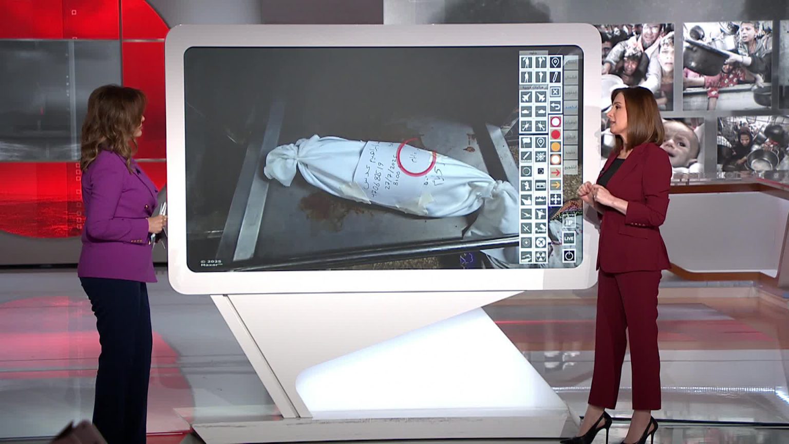 الجوع يقتل أطفال غزة بعد أيام من مولدهم