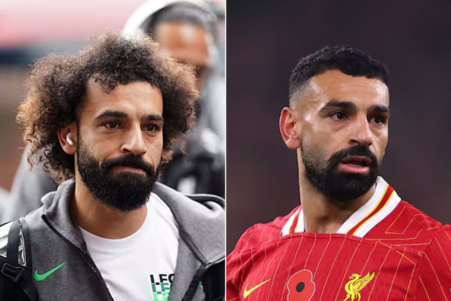 زراعة الشعر.. سر جديد في حياة نجوم الكرة