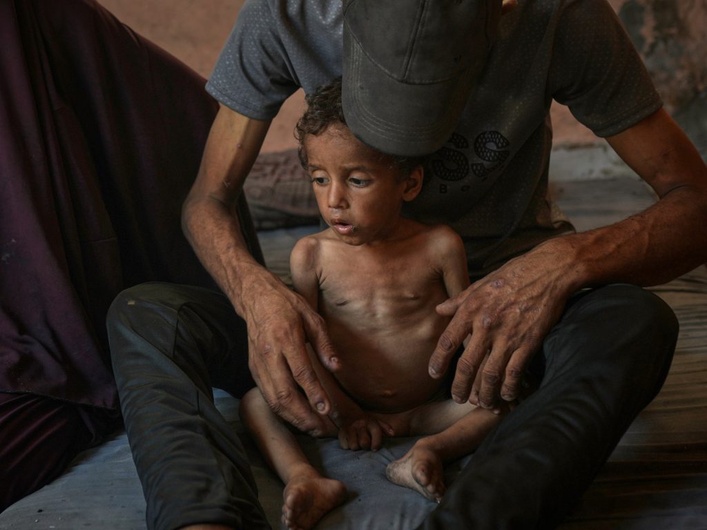 غزة تتضور جوعاً.. دفن الطفولة حيّة ونهب مستقبل فلسطين