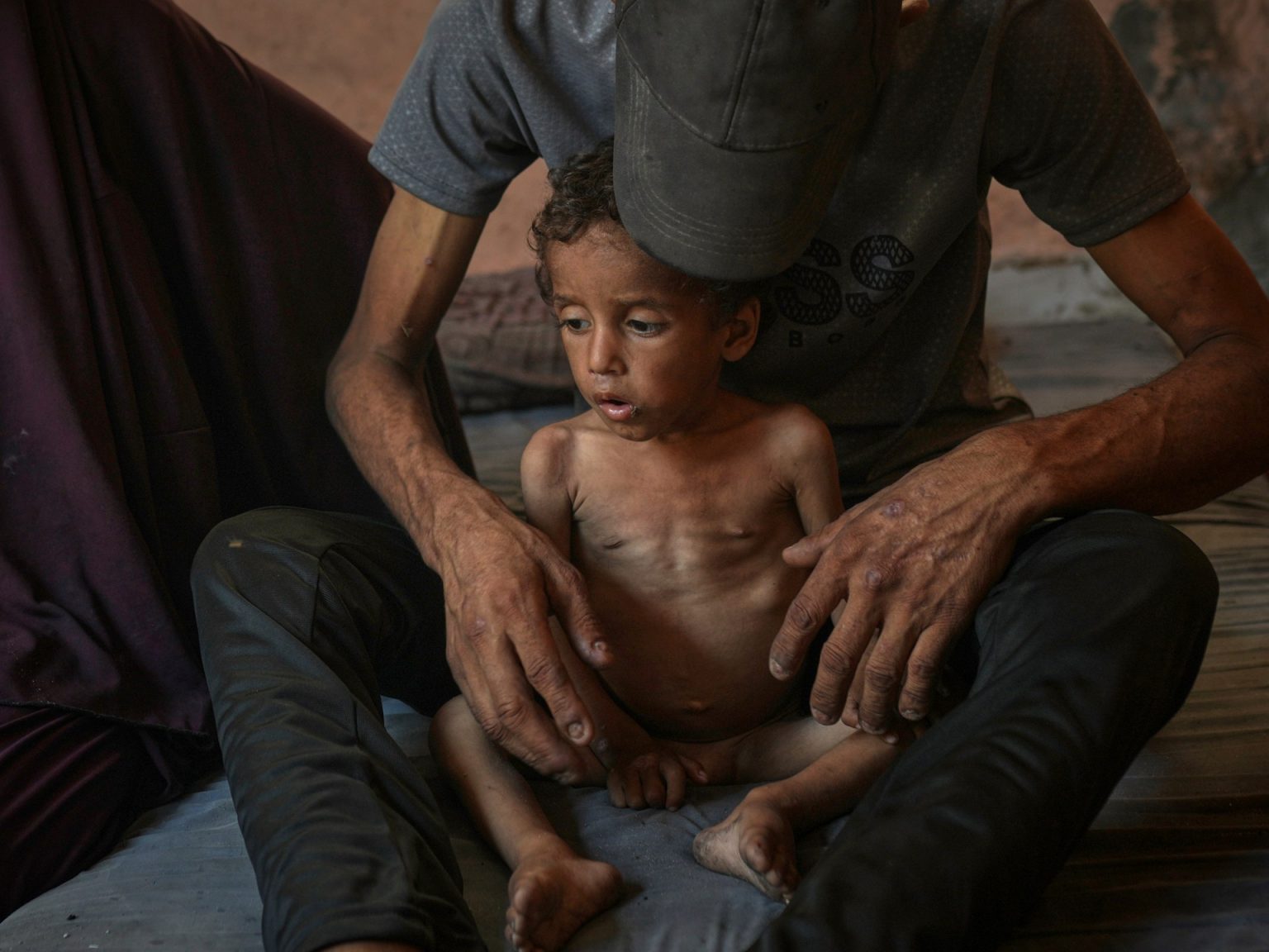 غزة تتضور جوعاً.. دفن الطفولة حيّة ونهب مستقبل فلسطين