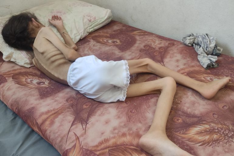 قصة... في عظام الطفلة مريم.. يبرز صوت المجاعة في غزة المحاصرة