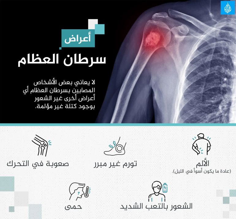 انفوغراف أعراض سرطان العظام