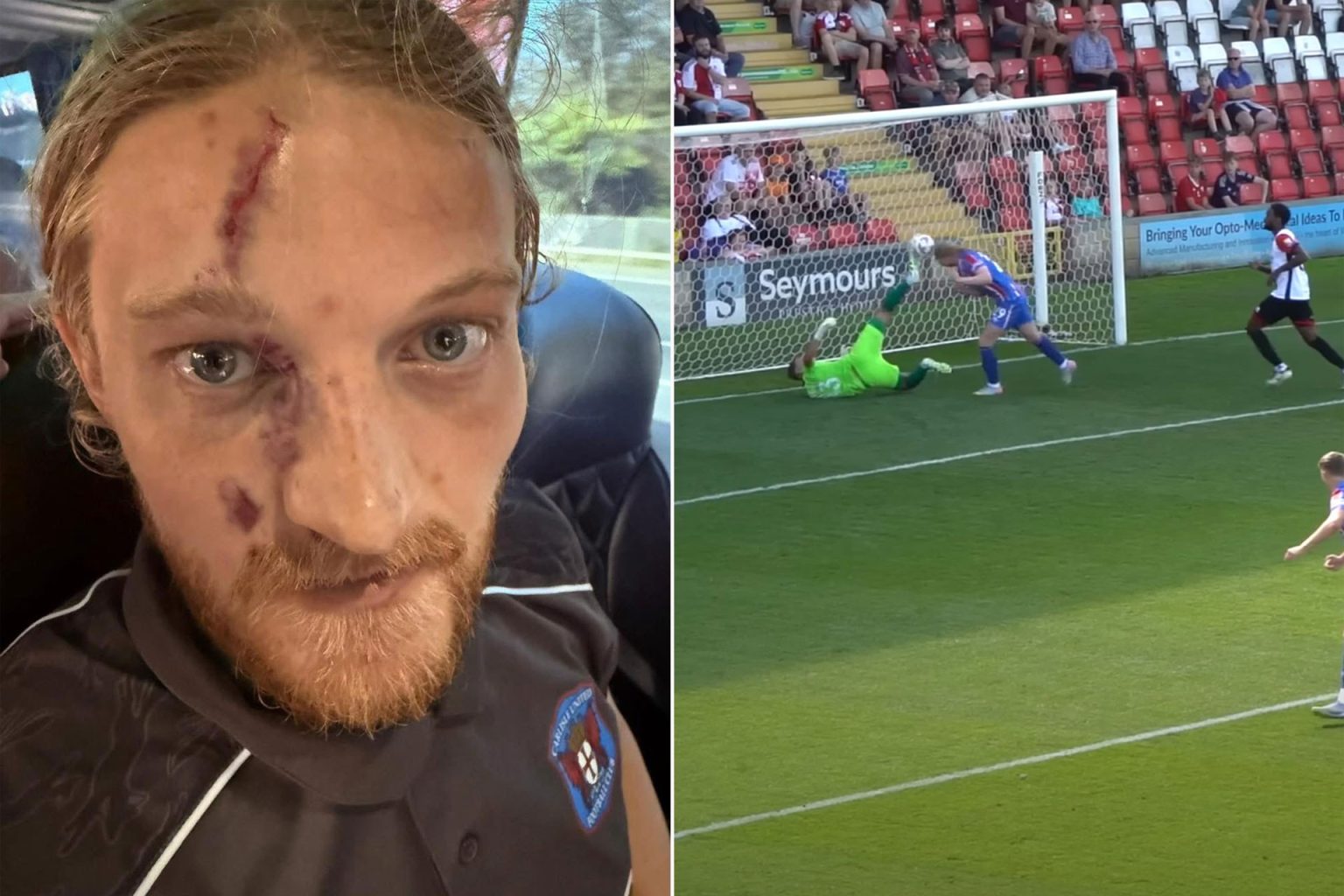 إصابة خطيرة تشوّه وجه لاعب إنجليزي بعد اصطدامه بحارس مرمى