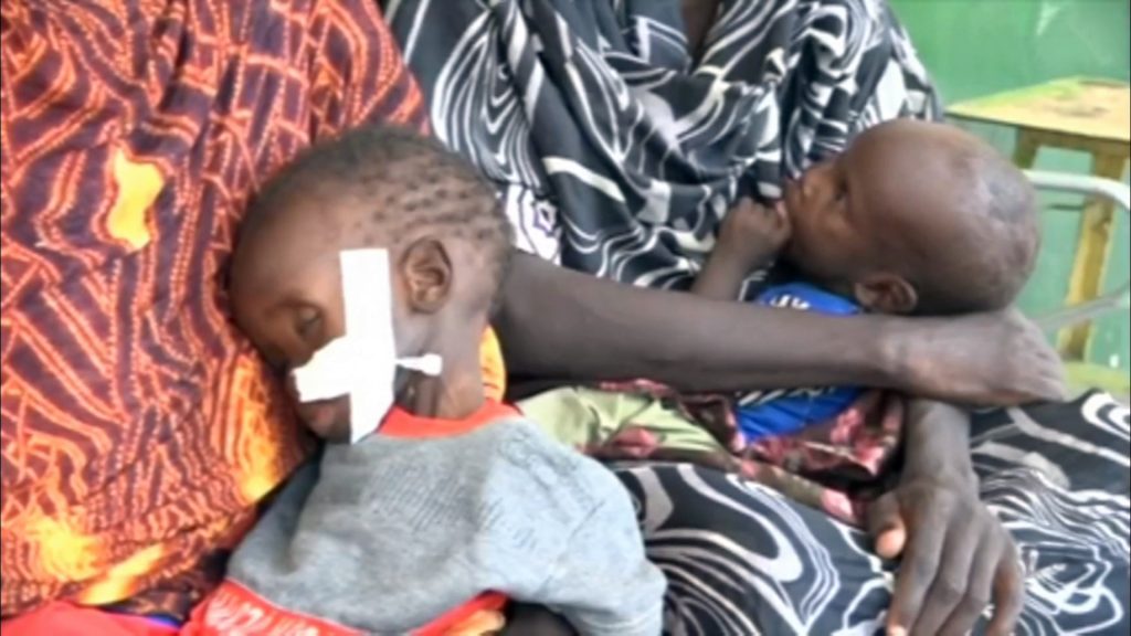 تفاقم الوضع الإنساني جنوب كردفان بسبب الجوع والأوبئة