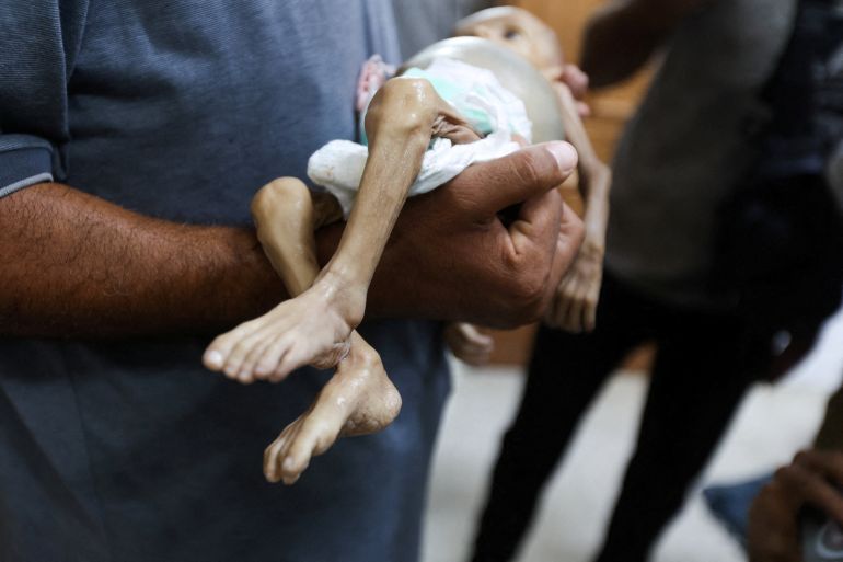 SENSITIVE MATERIAL. THIS IMAGE MAY OFFEND OR DISTURB A man carries the body of Palestinian baby Zainab Abu Haleeb, who died due to malnutrition, according to health officials, at Nasser Hospital in Khan Younis, southern Gaza Strip, July 26, 2025. REUTERS/Ramadan Abed TPX IMAGES OF THE DAY