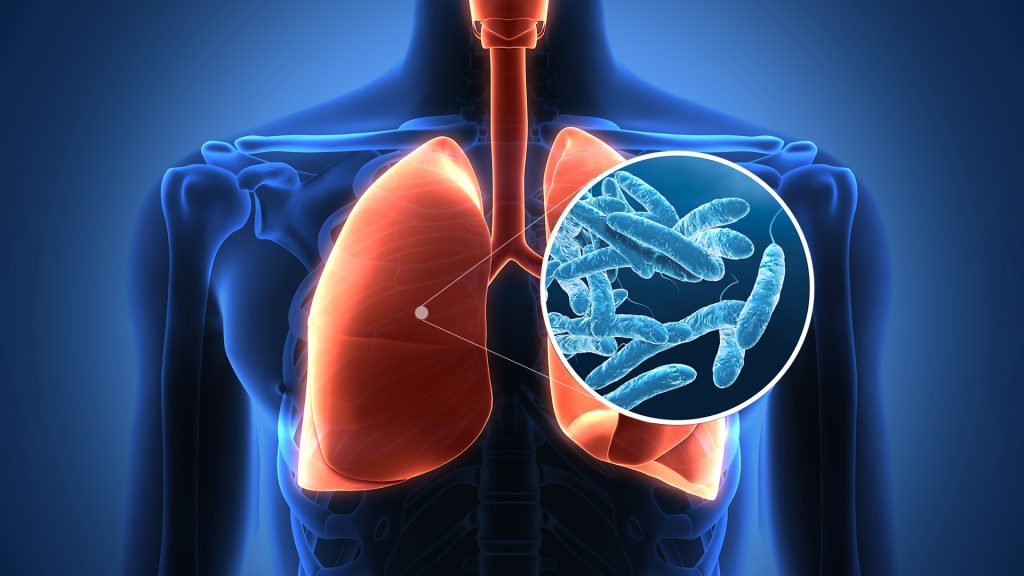 وفاة خامس شخص بداء الفيالقة في نيويورك