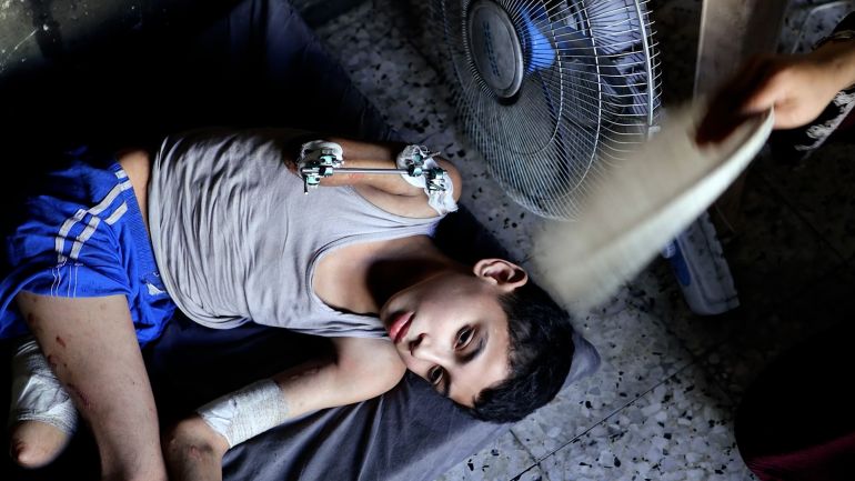 الطفل سمير يحلم بتركيب أطراف صناعية ليعود إلى حياته الطبيعية وطفولته المسلوبة