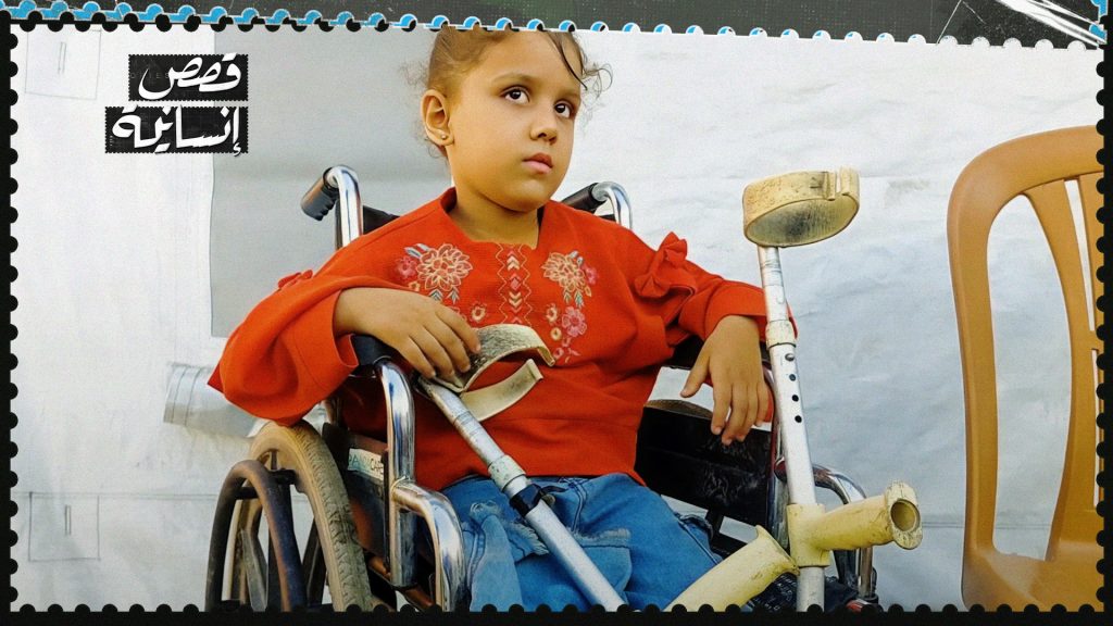 ملك.. طفلة من غزة تحلم بقدم تعيدها إلى الطفولة
