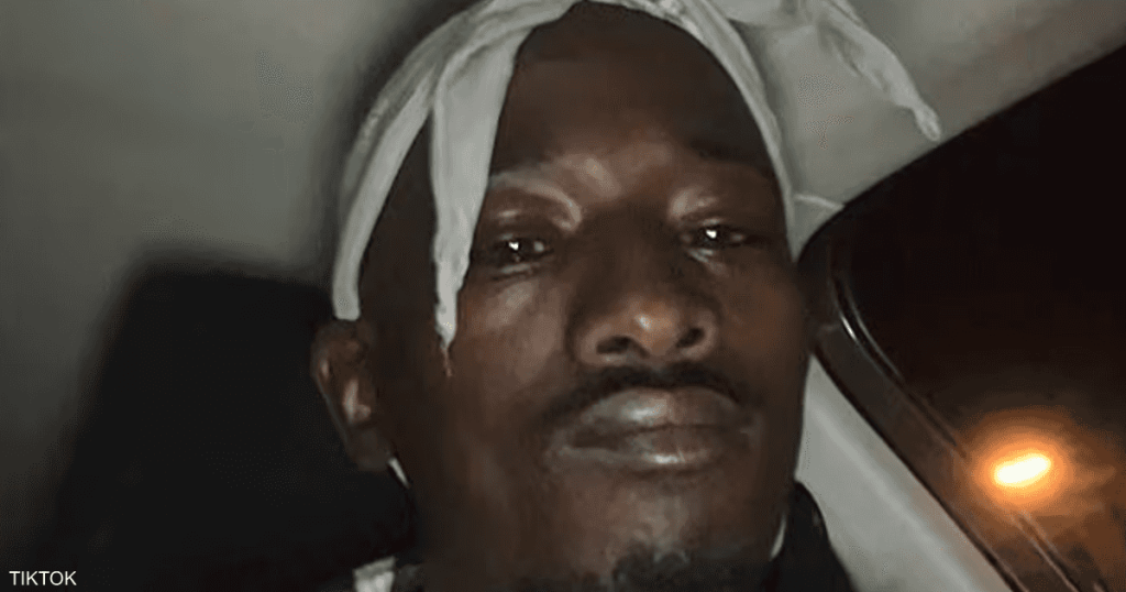 “دودو كروس بيتوم” في قلب فضيحة سرقة متحف اللوفر